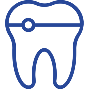 Dental Veneers