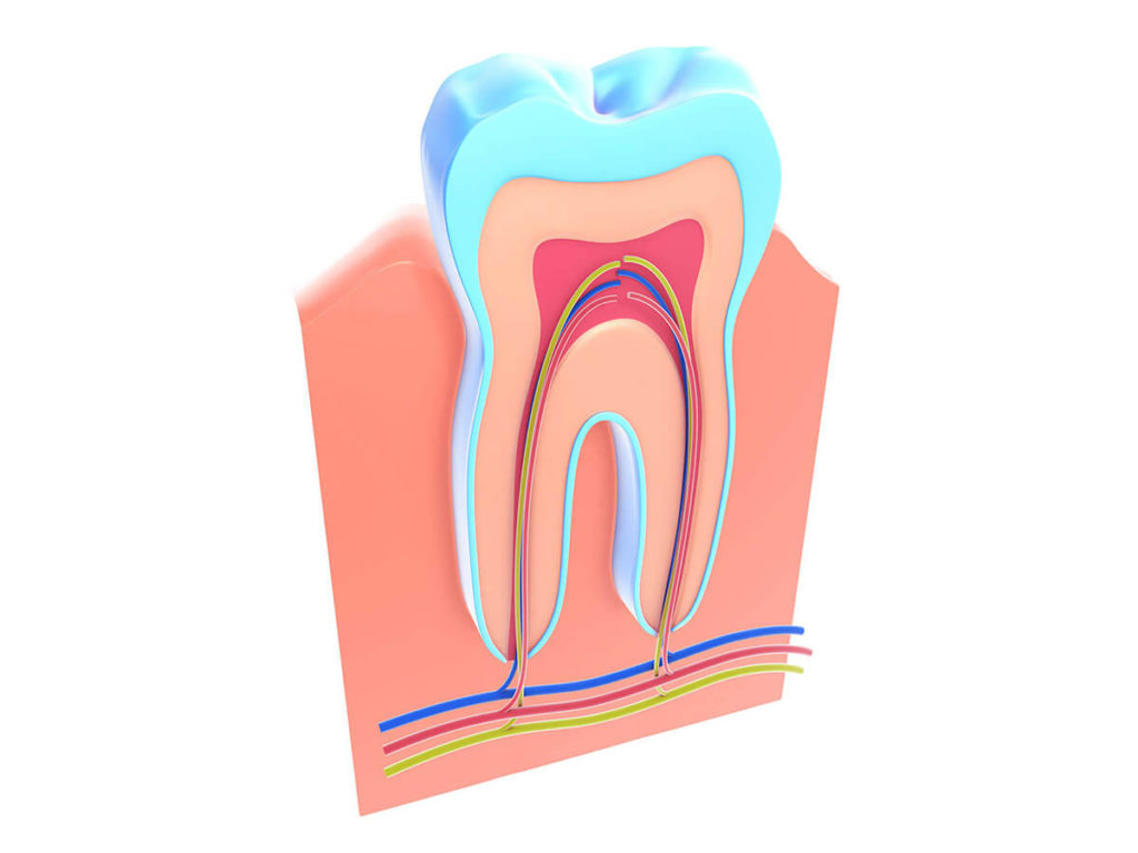 illustration of a tooth's root structure where a root canal is needed
