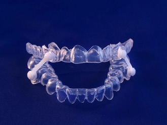 Clear dental aligners displayed on a dark blue background, representing orthodontic treatment available at River Valley Dentistry.