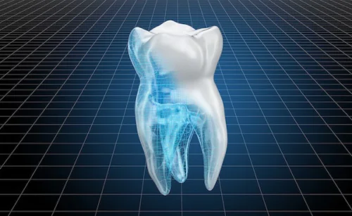 Denta CAD/CAM Technology in Chattanooga, TN at River Valley Dentistry