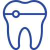 Dental Veneers